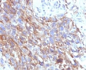 NCAM / CD56 Antibody (clone CDLA56, Azide-free, BSA-free)
