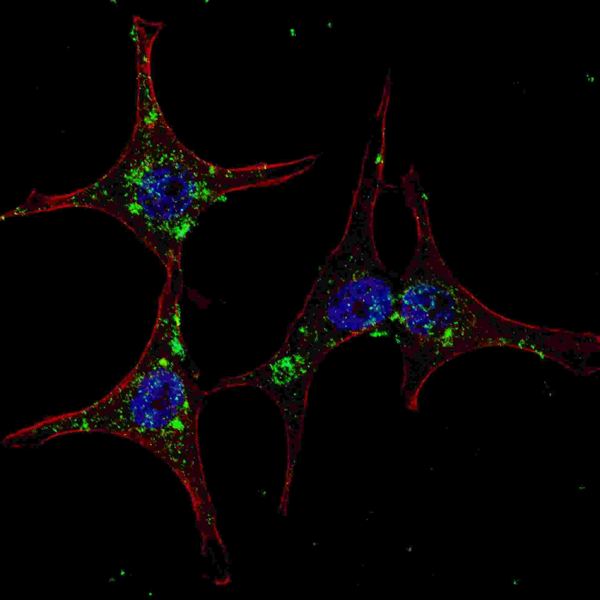 IHC-plus™ Polyclonal Rabbit anti-Human SYVN1 / HRD1 Antibody (aa586-617, IHC, IF, WB)