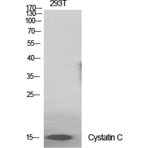 CST3 / Cystatin C Antibody (60-140 aa, Internal)