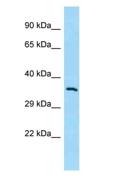 MCHR1 Antibody (aa56-105)