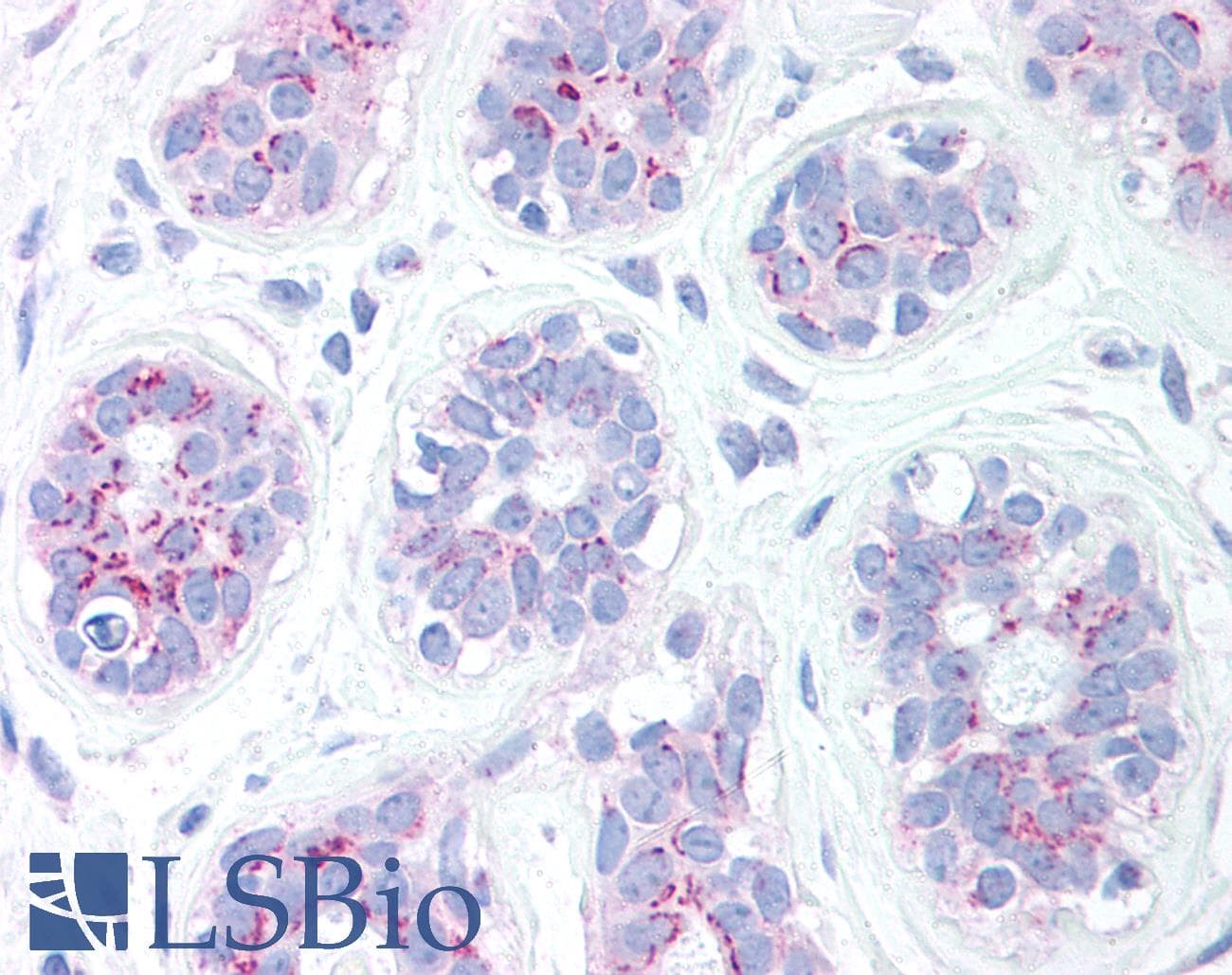 IHC-plus™ Polyclonal Rabbit anti-Human BBC3 / PUMA Antibody (IHC, IF, WB)