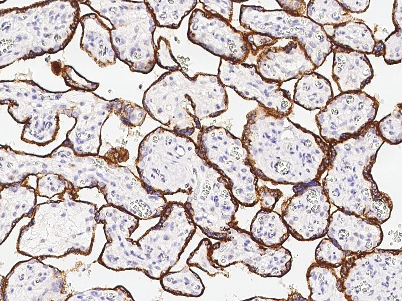 ERBB2 / HER2 Antibody (clone 40, Preservative Free)