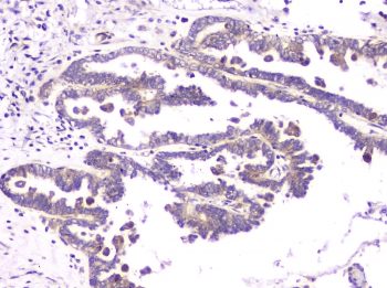 RAB11B Antibody