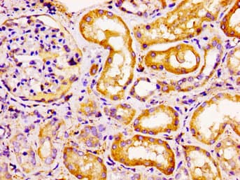 CCRL2 Antibody