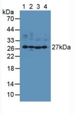 UCHL1 / PGP9.5 Antibody (aa2-223)