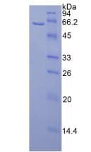 Mouse CALB1 / Calbindin Protein (Recombinant His-GST)
