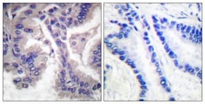 Polyclonal Rabbit anti-Mouse CASP6 / Caspase 6 Antibody (aa144-193, IHC, WB)