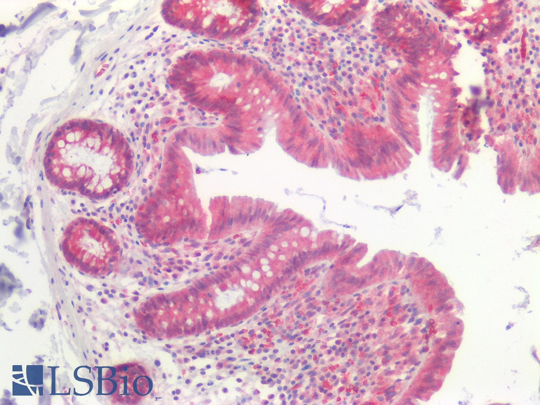 PathPlus™ NOX1 Antibody