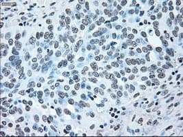 BRAF / B-Raf Antibody (clone OTI4C5)