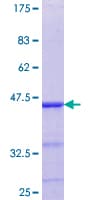 Human ELK4 Protein (Recombinant GST, N-terminus)
