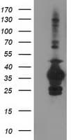IHC-plus™ SULT1C2 / Sulfotransferase 1C2 Antibody (clone 4H4)