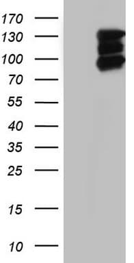 HDAC4 Antibody (clone OTI1E1)