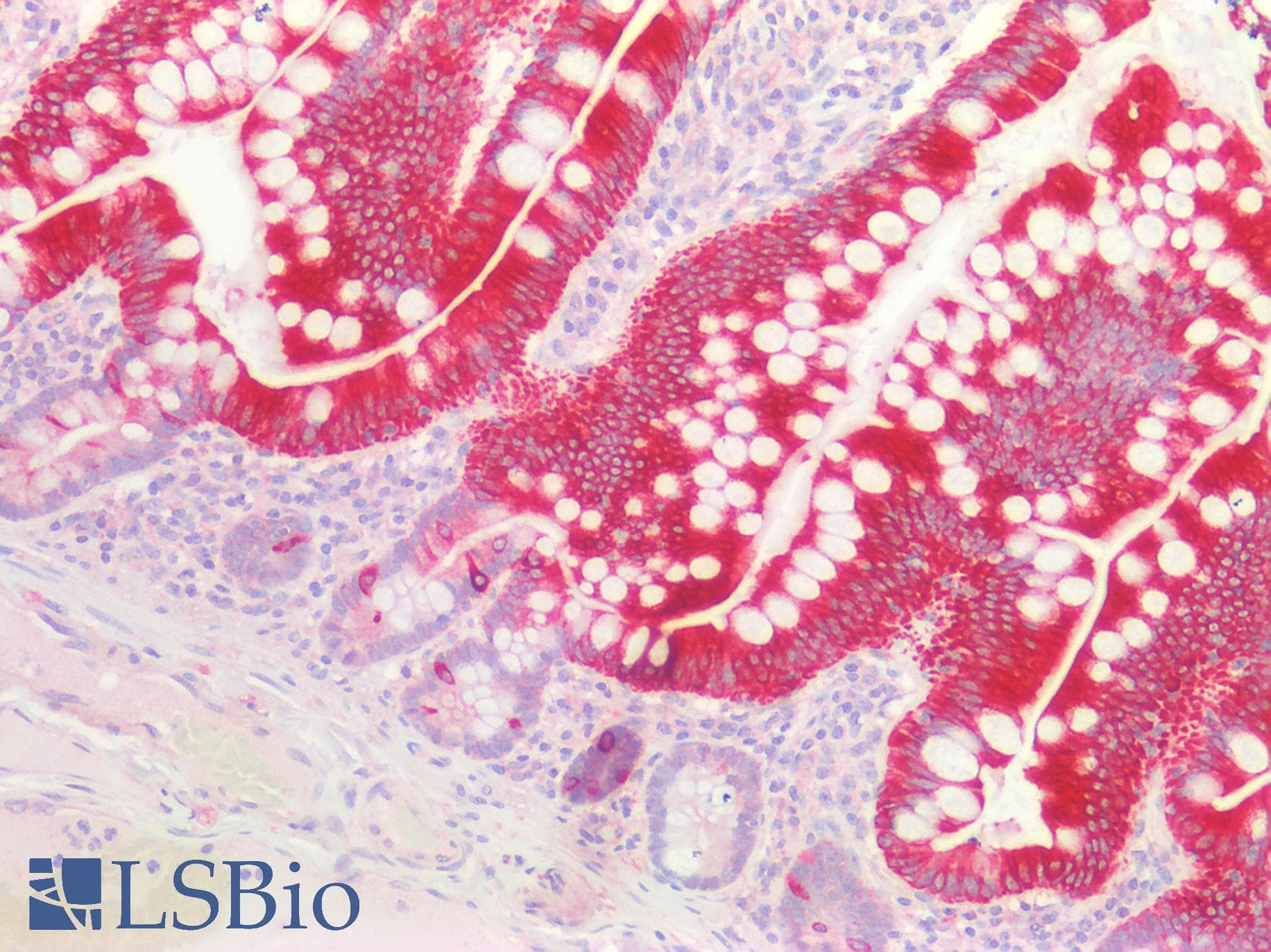 IHC-plus™ Polyclonal Rabbit anti-Human KRT20 / CK20 / Cytokeratin 20 Antibody (aa75-317, IHC, IF, WB)