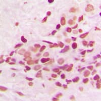 PKNOX2 Antibody (C-Terminus)