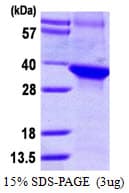Human DCAF7 / WDR68 Protein (Recombinant His)