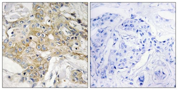 Polyclonal Rabbit anti-Human TM4SF1 Antibody (IHC)