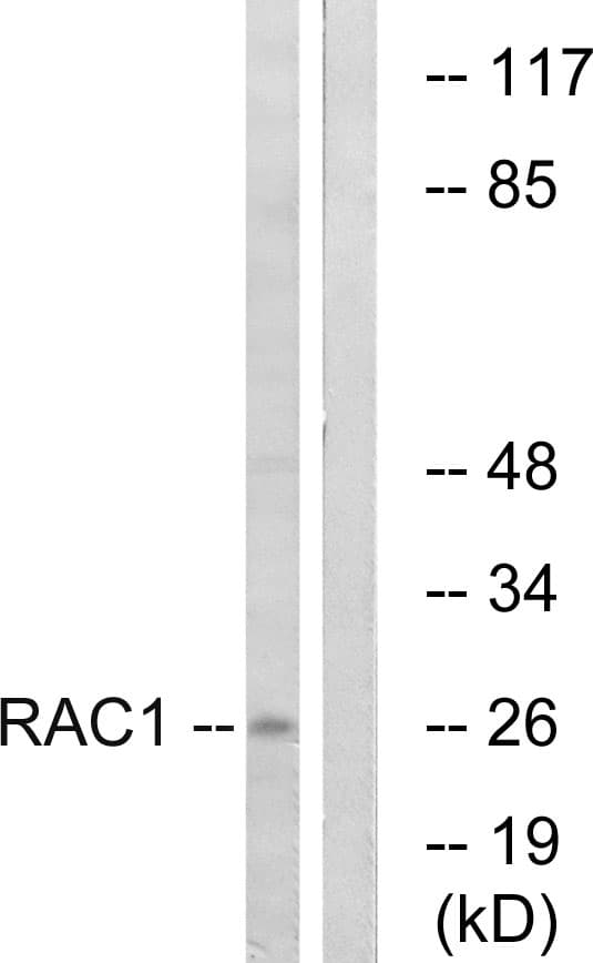 RAC1 Antibody (Internal)