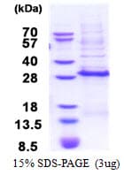 Human DLX3 Protein (Recombinant His)