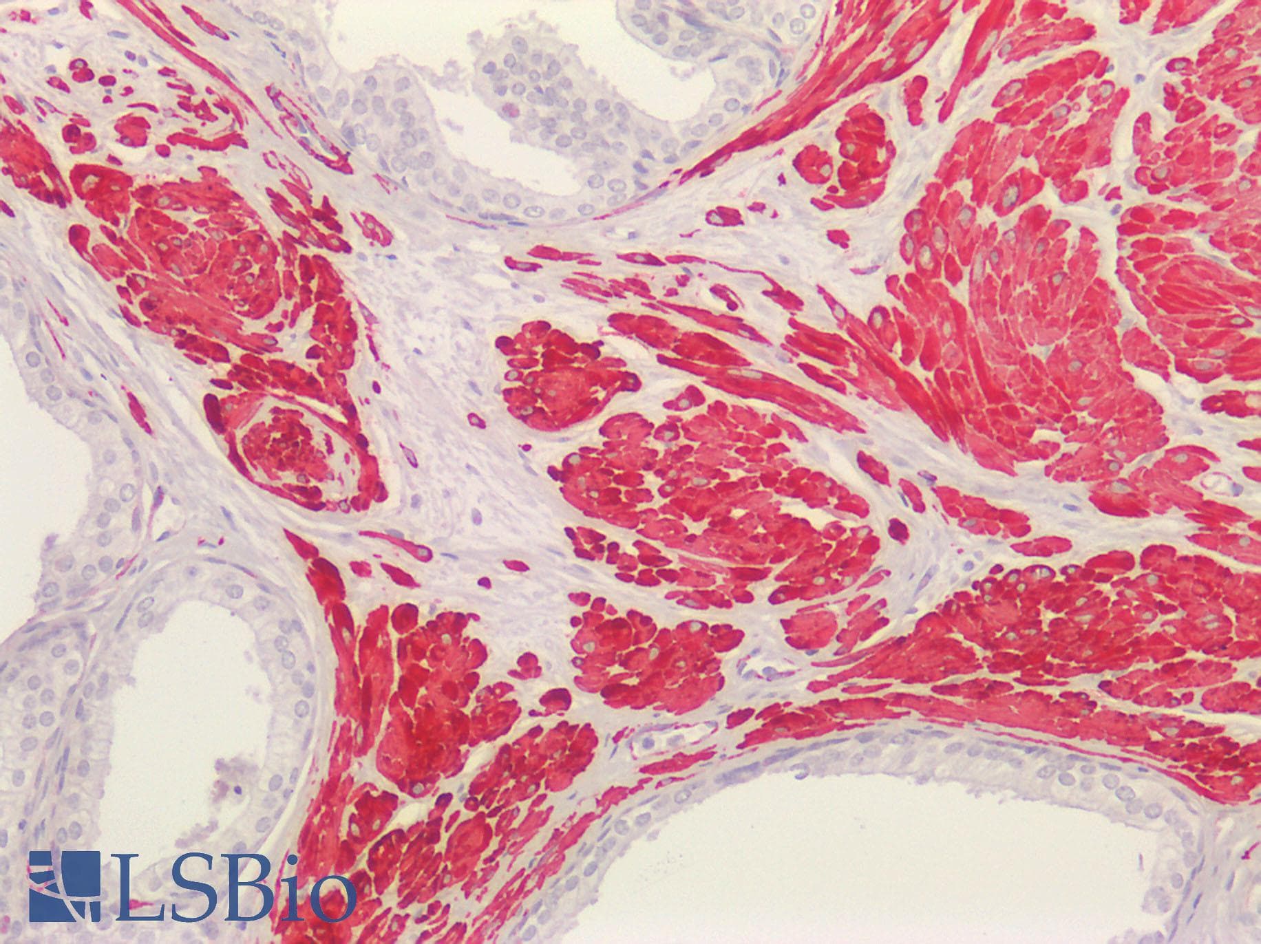 IHC-plus™ ACTA2 / Smooth Muscle Actin Antibody (N-Terminus)