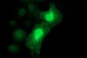LYZ / Lysozyme Antibody (clone OTI2C2)