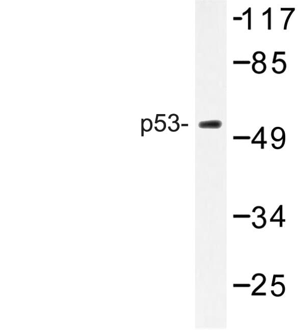 Polyclonal Rabbit anti-Human TP53 / p53 Antibody (Gly372, WB)