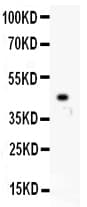 IKBKB / IKK2 / IKK Beta Antibody