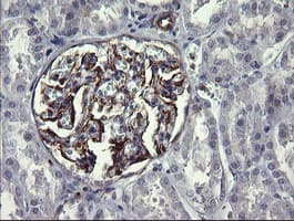 Monoclonal Mouse anti-Human TRIM38 Antibody (clone OTI16D9, IHC, WB)