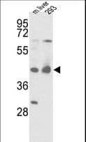 IDH1 / IDH Antibody (aa63-90)