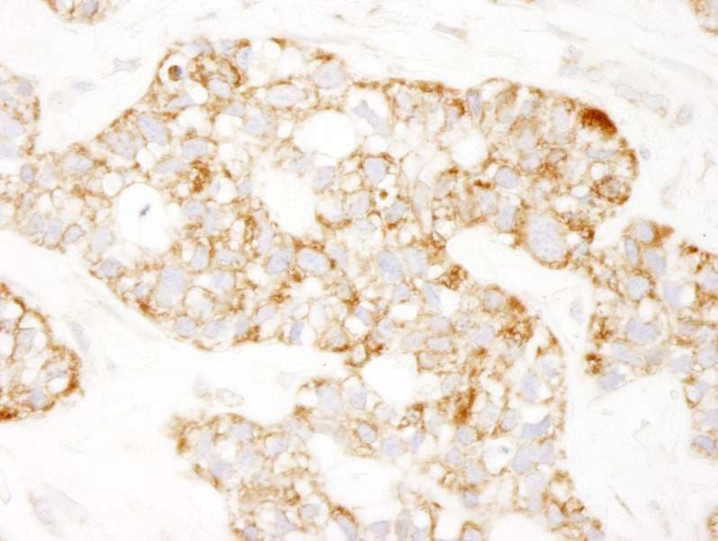 PHB / Prohibitin Antibody (aa222-272)
