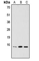 PDRG1 Antibody (Internal)