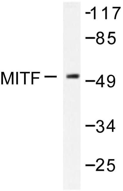 Polyclonal Rabbit anti-Human MITF Antibody (Gly174, IHC, IF, WB)