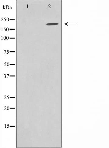 Sodium Channel Antibody
