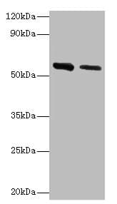 Polyclonal Rabbit anti-Human ADSL / Adenylosuccinate Lyase Antibody (aa1-310, IHC, WB)
