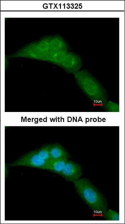 PathPlus™ WWOX Antibody