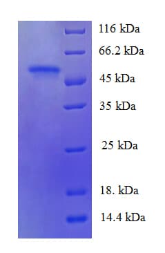 Human PDZK1 Protein (Recombinant His)