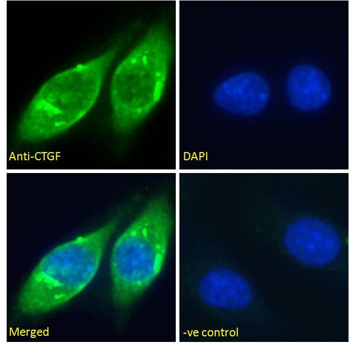 IHC-plus™ CTGF Antibody (Amino Acids 111-123)