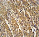 Polyclonal Rabbit anti-Human PDXDC1 Antibody (aa759-788, IHC, WB)