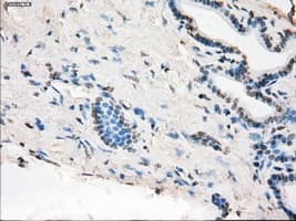 MAP2K1 / MKK1 / MEK1 Antibody (clone OTI1F5)