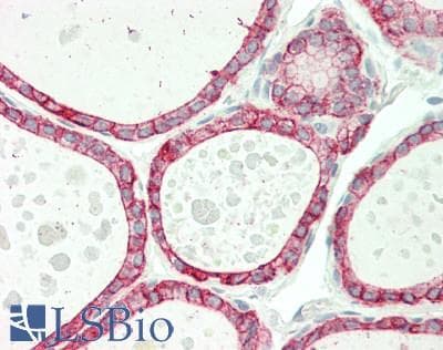 PathPlus™ KRT7 / CK7 / Cytokeratin 7 Antibody (C-Terminus)