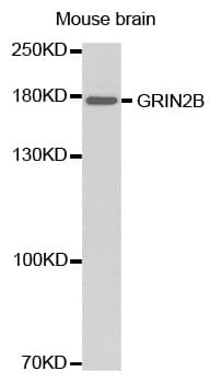 Polyclonal Rabbit anti-Human GRIN2B / NMDAR2B / NR2B Antibody (WB)