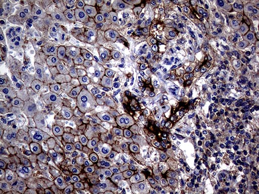 Monoclonal Mouse anti-Human ABCB1 / MDR1 / P Glycoprotein Antibody (clone OTI16D9, aa995-1280, IHC, WB)