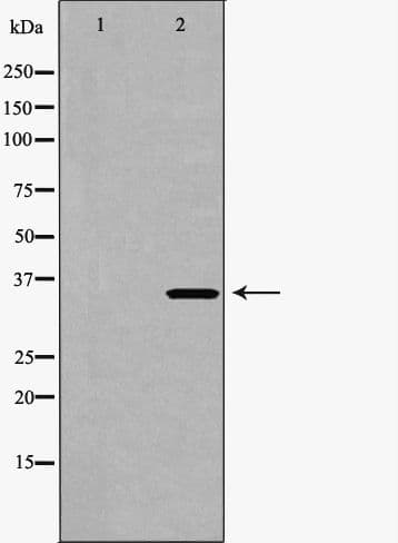 CDK6 Antibody