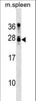 Polyclonal Rabbit anti-Mouse TUSC1 Antibody (aa111-138, WB)