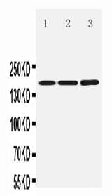 Polyclonal Rabbit anti-Human GRIN2B / NMDAR2B / NR2B Antibody (aa1307-1320, WB)