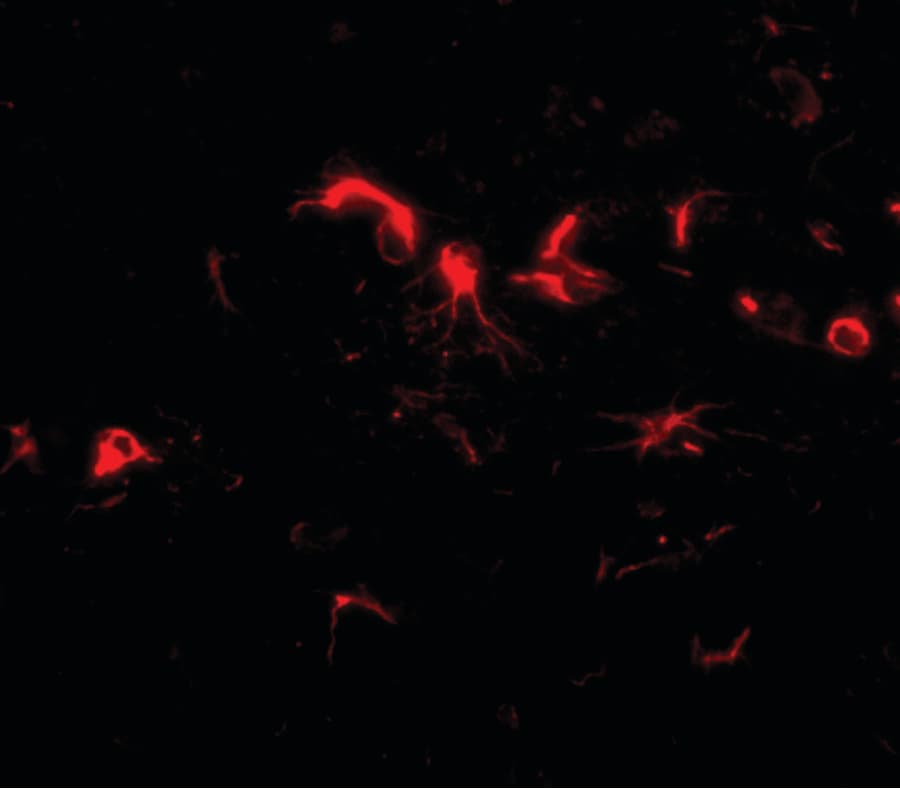 IHC-plus™ NIPSNAP3B Antibody