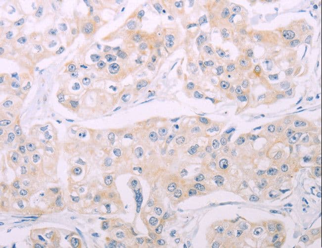 Polyclonal Rabbit anti-Human ADCY7 / Adenylate Cyclase 7 Antibody (IHC)