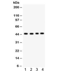 Polyclonal Rabbit anti-Human TSG101 Antibody (WB)