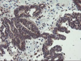 GCP60 / ACBD3 Antibody (clone OTI3A1)