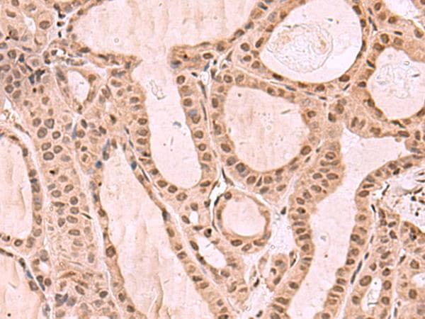 KDM7A / JHDM1D Antibody