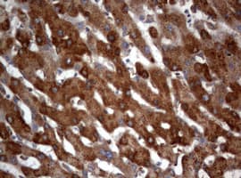 Monoclonal Mouse anti-Human PIK3C2A Antibody (clone OTI2D9, aa230-560, IHC, WB)